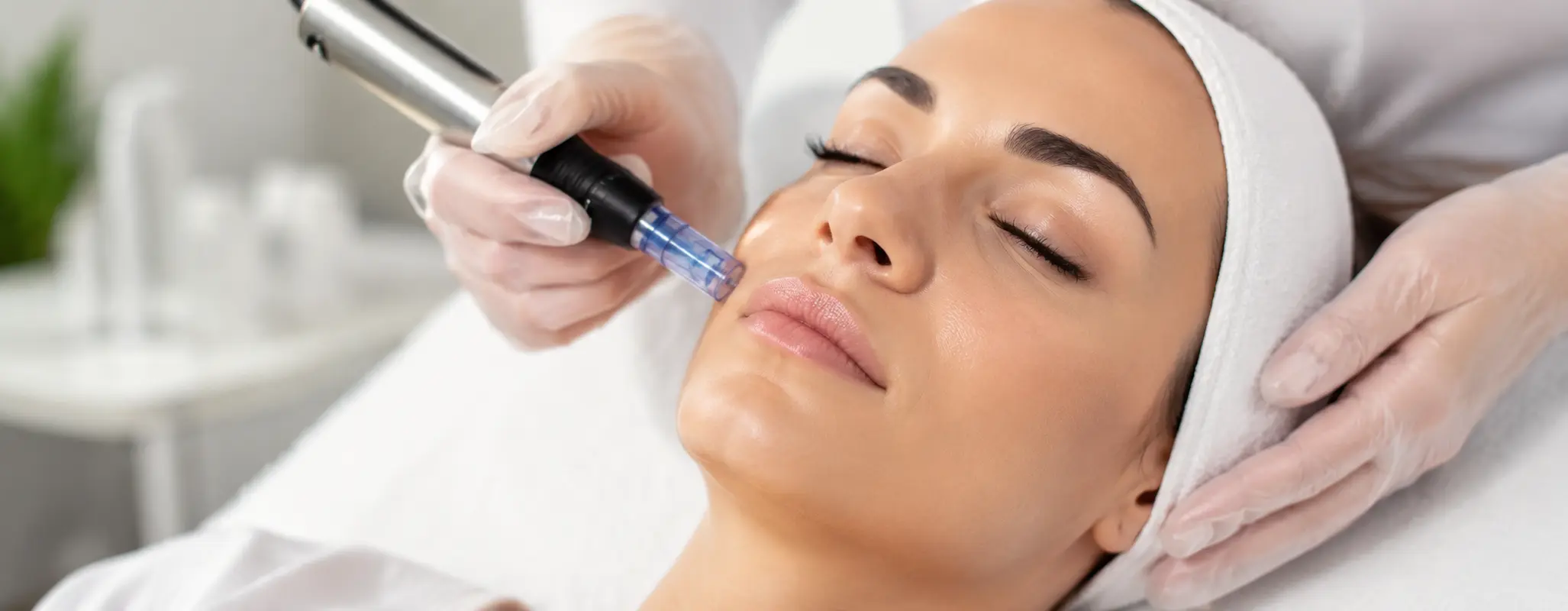 Microagulhamento facial na H2o Estética Leiria